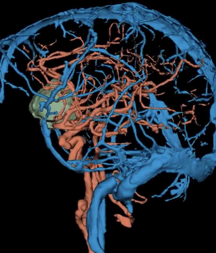 radiology plus 3d-rendering