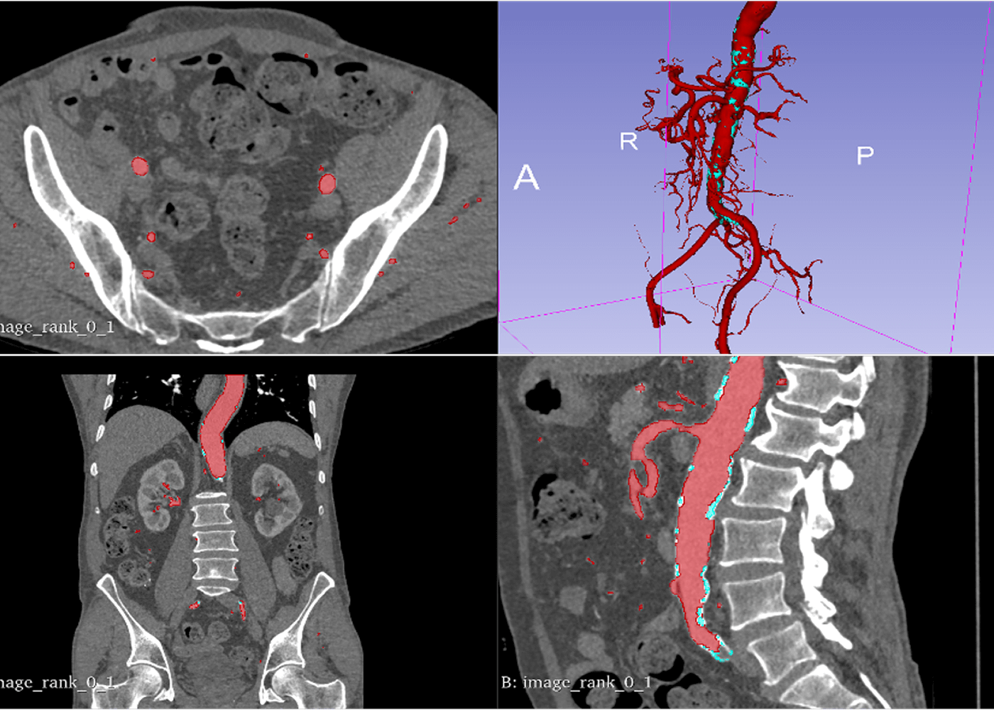 radiology-slide-4