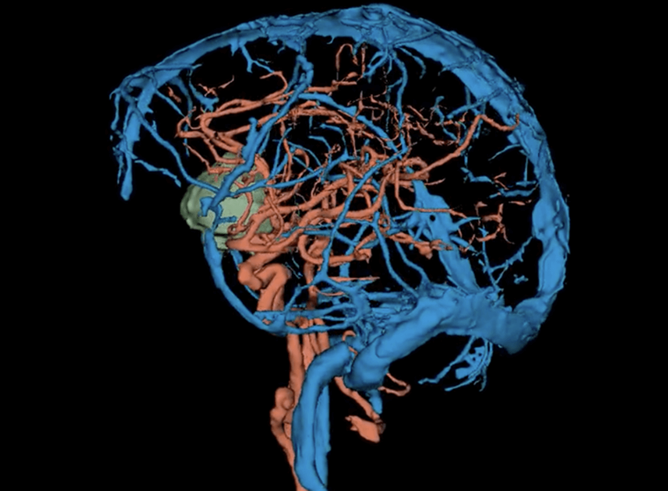Radiology and 3D-Rendering
